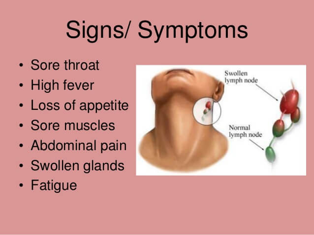 symptoms of mono in adults