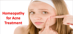 How Much Homeopathy Effective In Treating Acne? How Much Homeopathy Effective In Treating Acne?