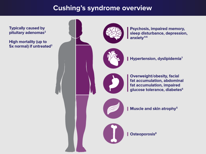 Treatment For Cushing's Syndrome - Philadelphia Homeopathic Clinic