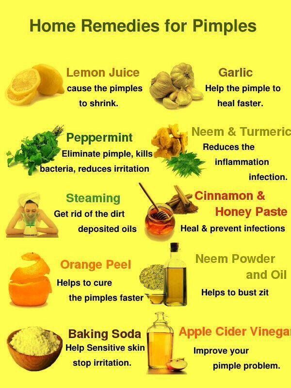 Home remedies