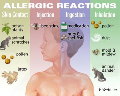 Types of allergic reaction