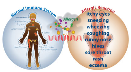 Allergy