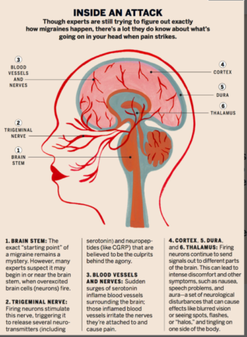 Treatment for Migraines - Philadelphia Homeopathic Clinic - Dr. Tsan & Co.