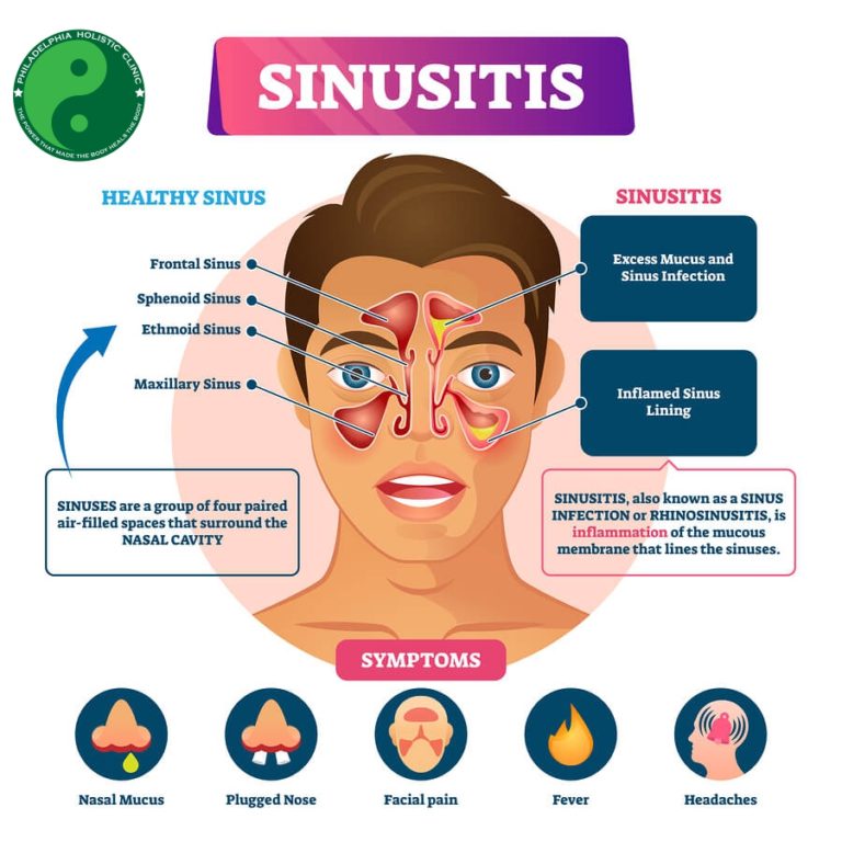 Treatment For Sinus Infection - Philadelphia Homeopathic Clinic - Dr. Tsan