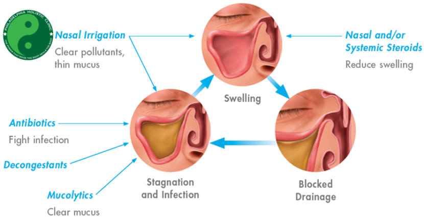 Treatment For Sinus Infection Philadelphia Homeopathic Clinic Dr Tsan 4382