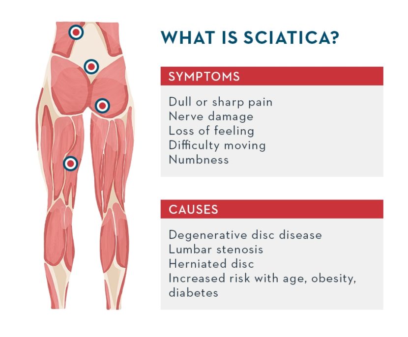 Treatment for Sciatica by Dr. Tsan at the Philadelphia Homeopathic Clinic