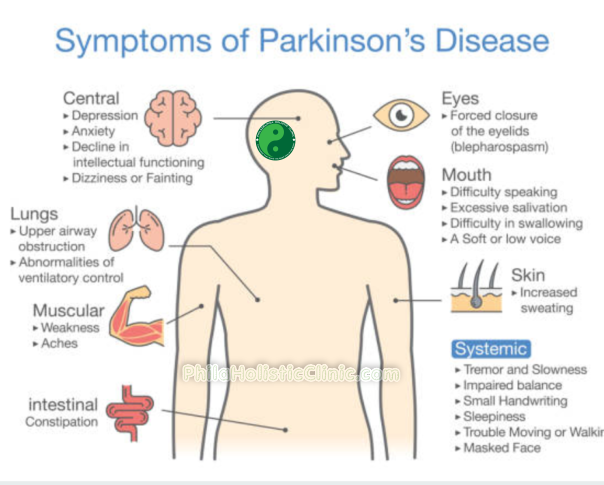 Symptoms of Parkinson's Disease 