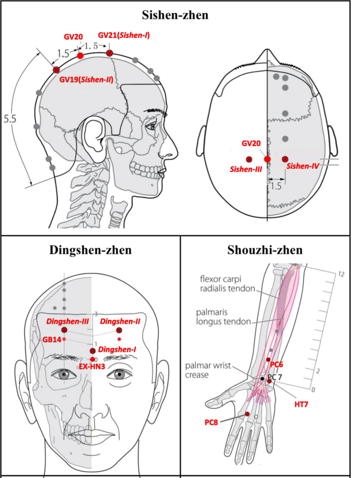 Acupuncture points