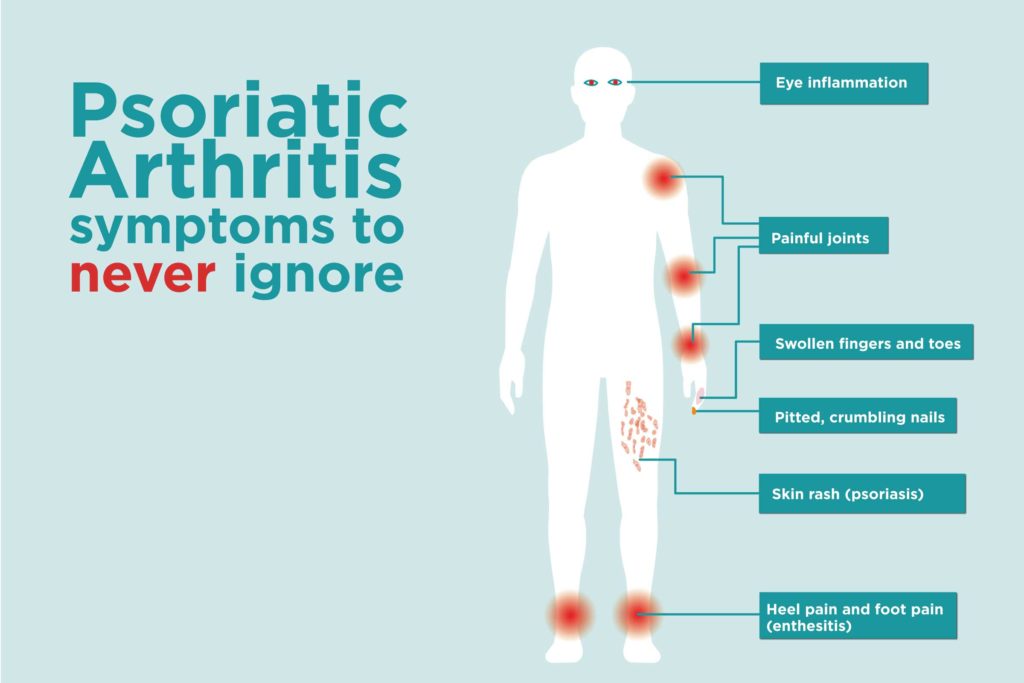 Treatment of Psoriasis @ Philadelphia Homeopathic Clinic - Dr. Victor Tsan