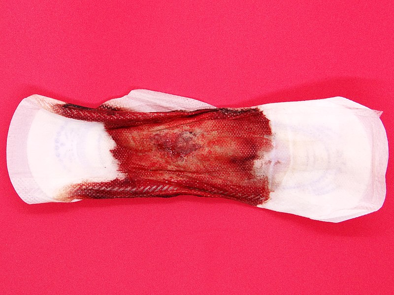 Menorrhagia treatment