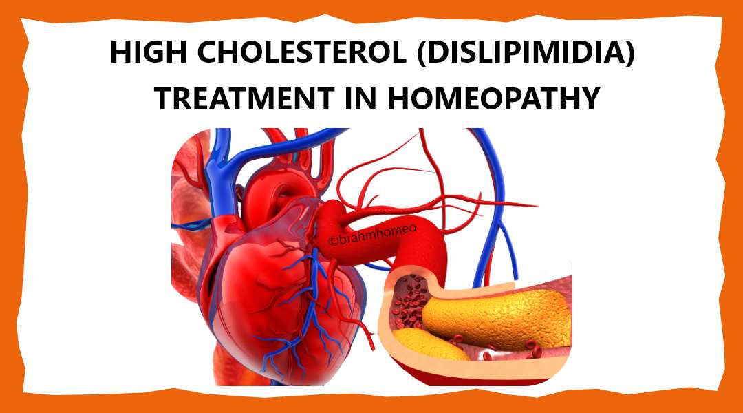 Homeopathy for dislipimidia and heart problems