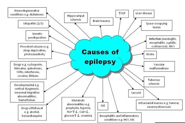 Causes of epilepsy