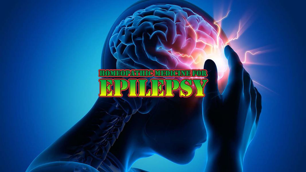 homeopathic medicine for epilepsy