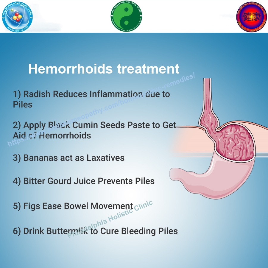 Treatment for Hemorrhoids Philadelphia Homeopathic Clinic Dr. Tsan