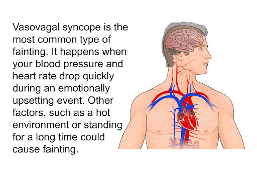 Vasovagal fainting
