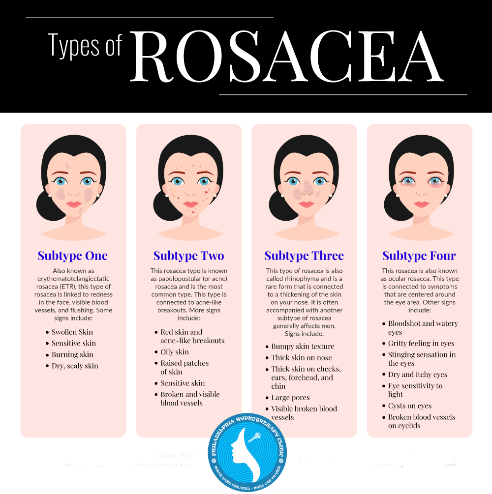 Types of couperoseis