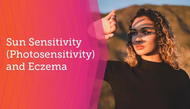Sun Allergy, Photosensitivity, Photodernatitis