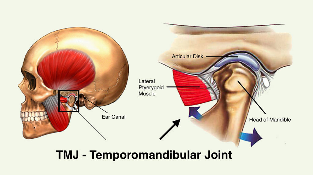 TMJ Dysfunction