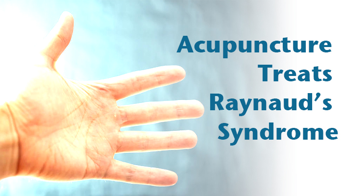 Acupuncture treats Raynaud's sumdrome