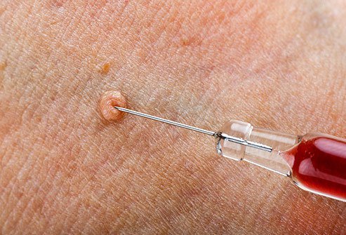 Chemicals for growths removal
