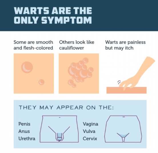 Symptoms of warts
