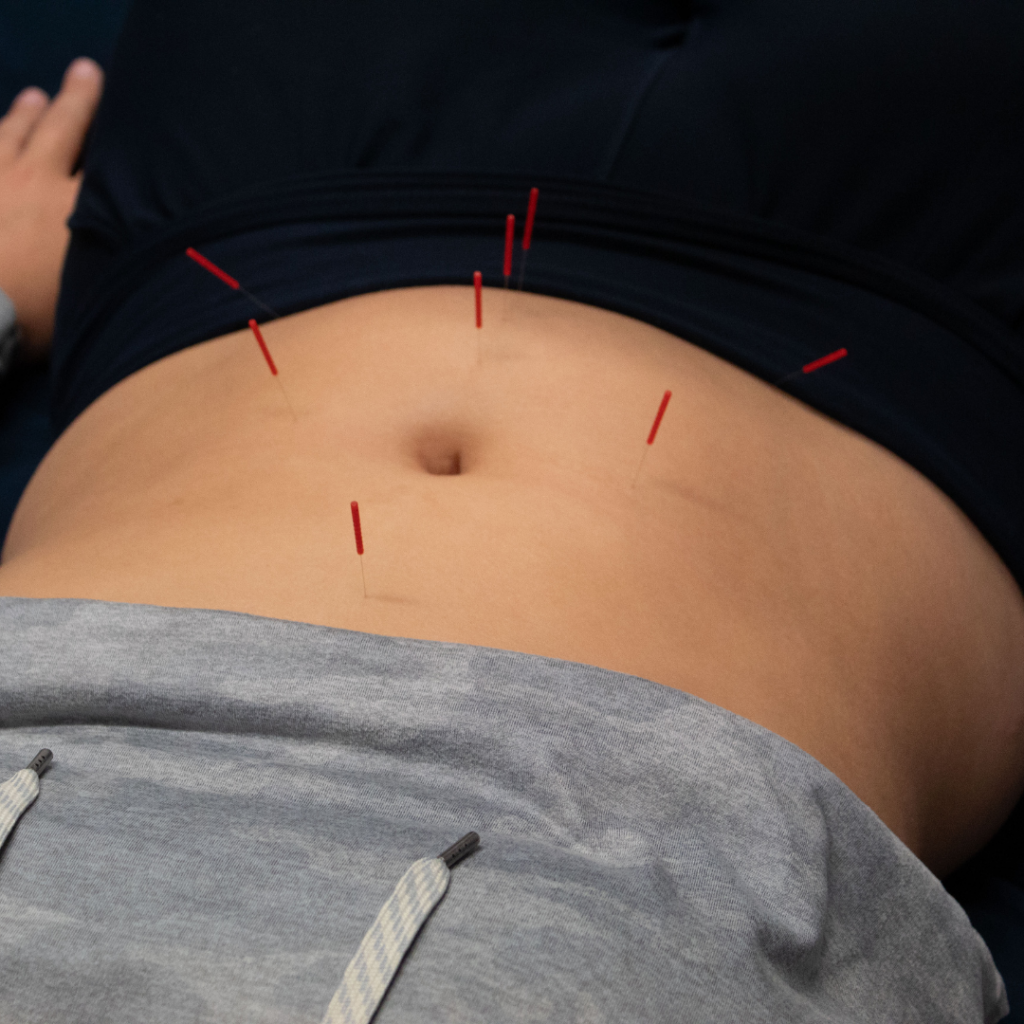 Acupuncture for gastroparesis