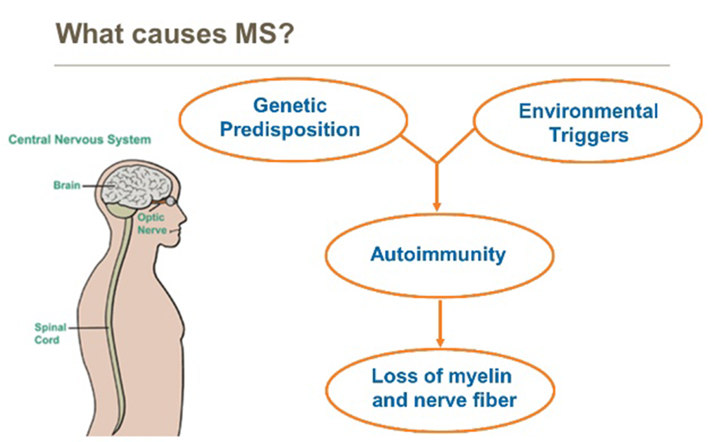 The causes of Multiple Sclerosis