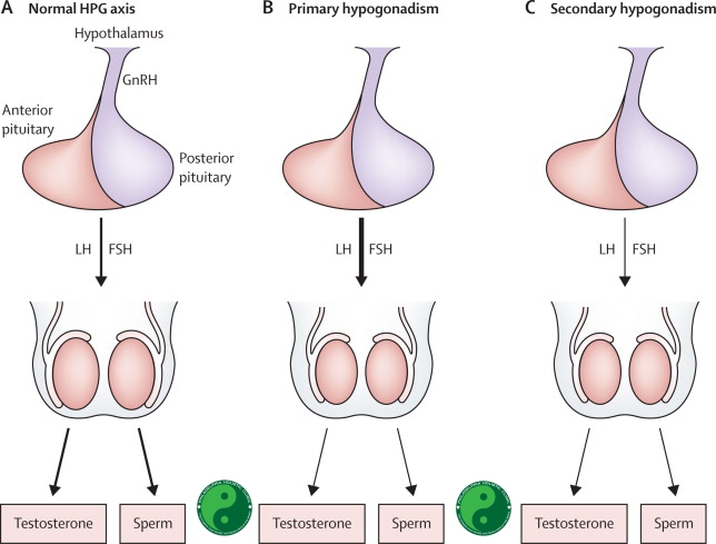 Hypogonadism Mechanism