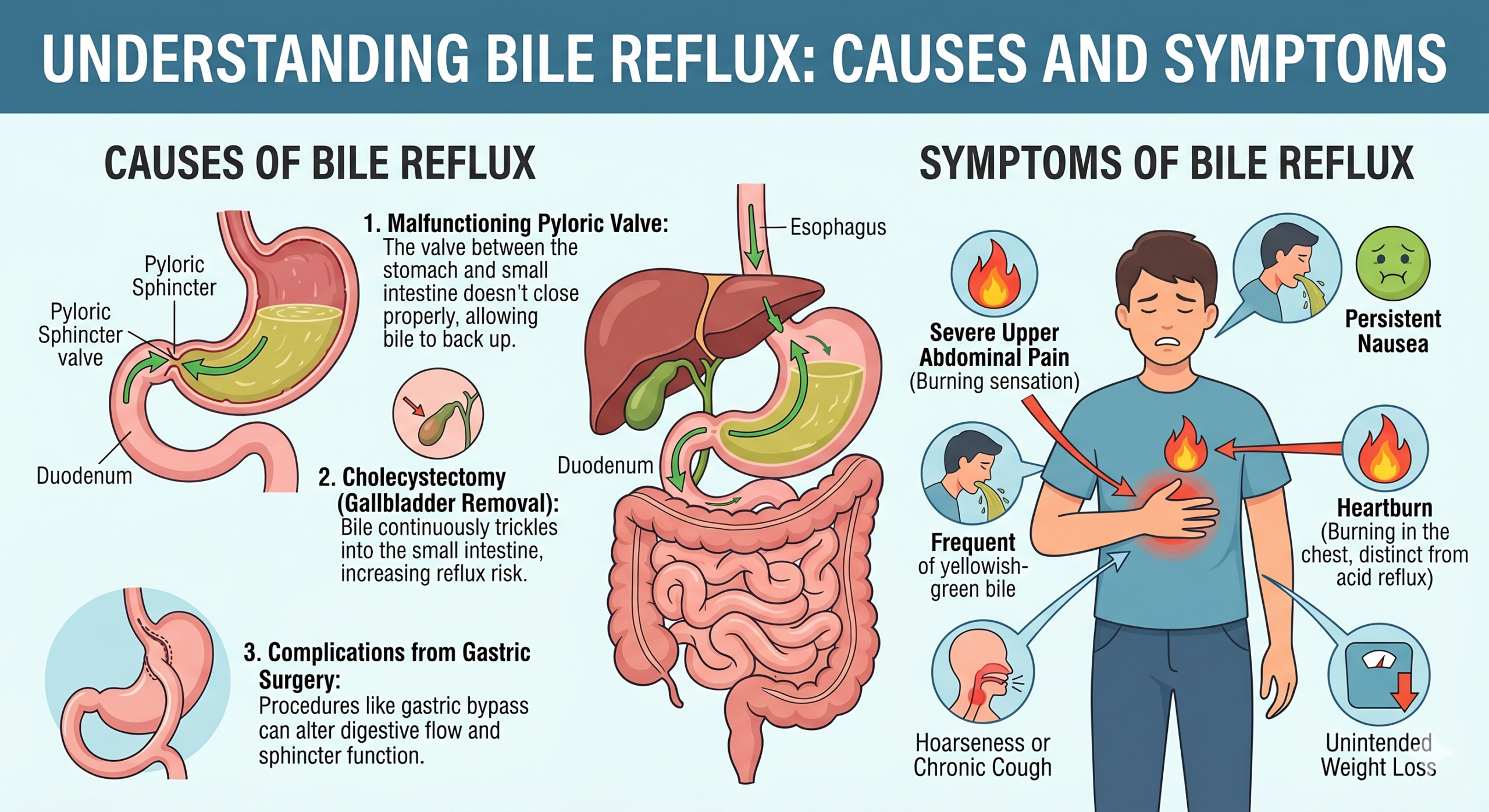 Bile Reflux causes and symptoms