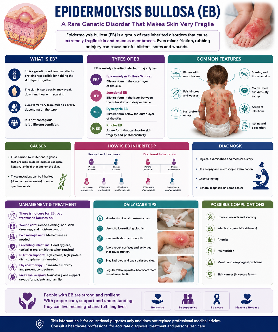 Epidermolysis Bullosa