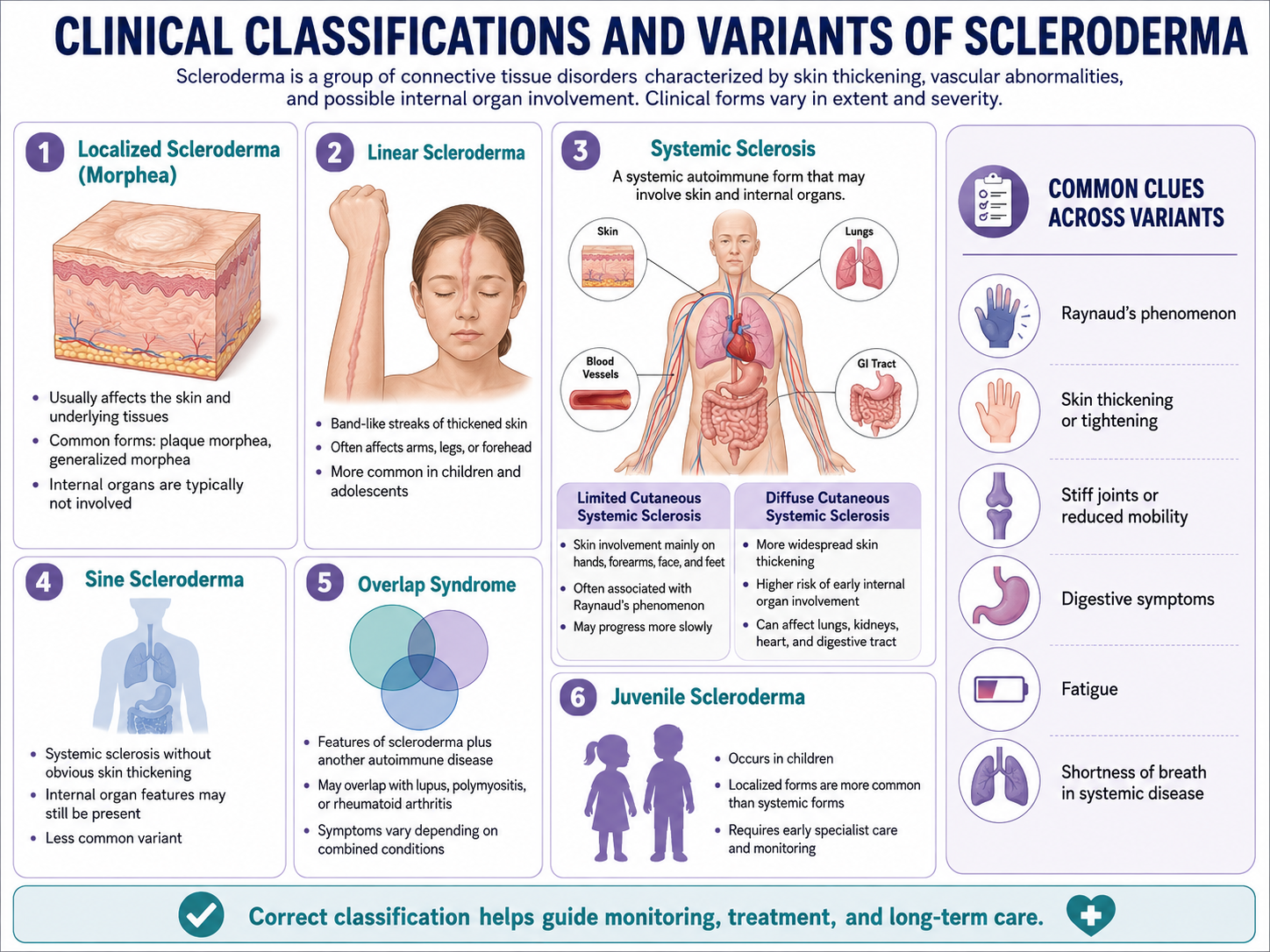 Clinical Classifications and Variants of Scleroderma