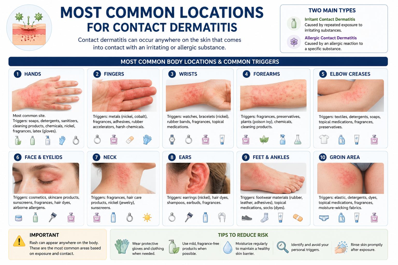 Common Locations for contact dermatitis