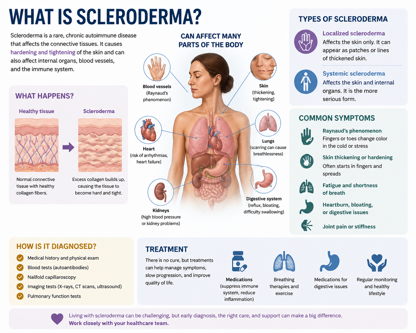 What is Scleroderma
