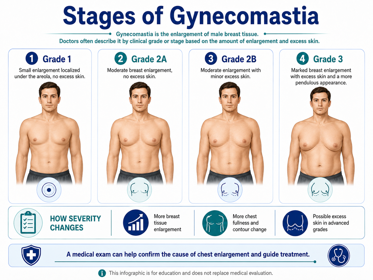 Stages of moobs