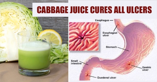 cabbage juice