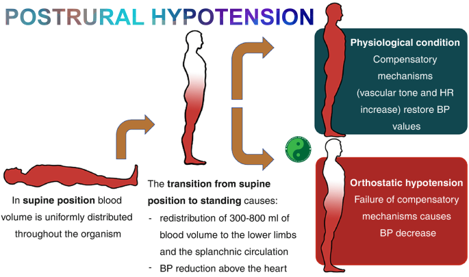 orthostatic hypotension